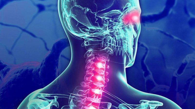 Detección temprana es clave para mejorar calidad de vida en pacientes con Esclerosis múltiple