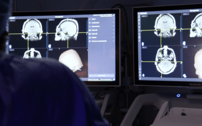 Conoce algunas claves para mantener un cerebro sano