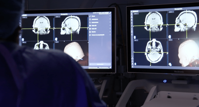 Conoce algunas claves para mantener un cerebro sano